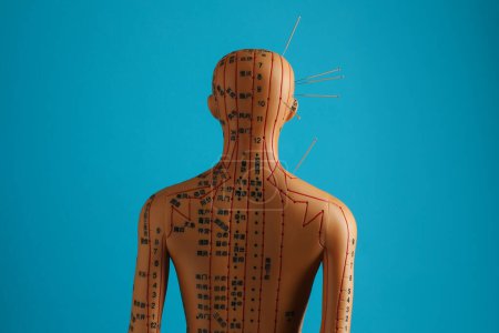 Téléchargez les photos : Acupuncture - médecine alternative. Modèle humain avec aiguilles dans la tête et l'épaule sur fond bleu clair, vue arrière - en image libre de droit