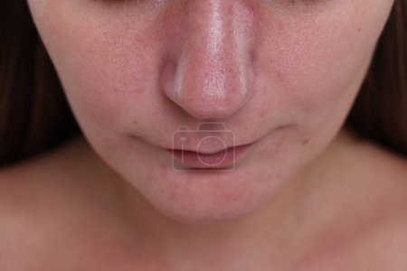 Téléchargez les photos : Vue rapprochée de la femme avec des points noirs sur le nez - en image libre de droit
