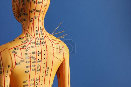 Téléchargez les photos : Acupuncture - médecine alternative. Modèle humain avec aiguilles dans le dos sur fond bleu. Espace pour le texte - en image libre de droit