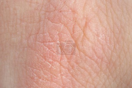 Textur der gesunden Haut als Hintergrund, Makroansicht