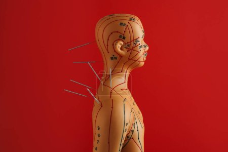 Téléchargez les photos : Acupuncture - médecine alternative. Modèle humain avec aiguilles dans la tête et l'épaule sur fond rouge - en image libre de droit