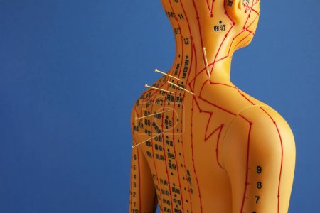 Téléchargez les photos : Acupuncture - médecine alternative. Modèle humain avec aiguilles dans le dos sur fond bleu, espace pour le texte - en image libre de droit