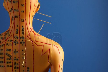 Téléchargez les photos : Acupuncture - médecine alternative. Modèle humain avec aiguilles dans la tête et l'épaule sur fond bleu, espace pour le texte - en image libre de droit