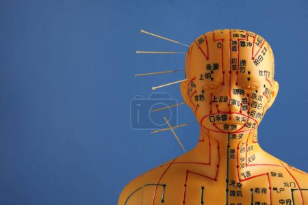 Téléchargez les photos : Acupuncture - médecine alternative. Modèle humain avec aiguilles dans la tête sur fond bleu, espace pour le texte - en image libre de droit