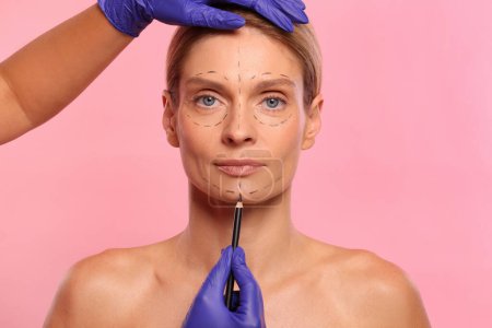 Photo for Doctor with pencil preparing patient for cosmetic surgery operation on pink background, closeup - Royalty Free Image