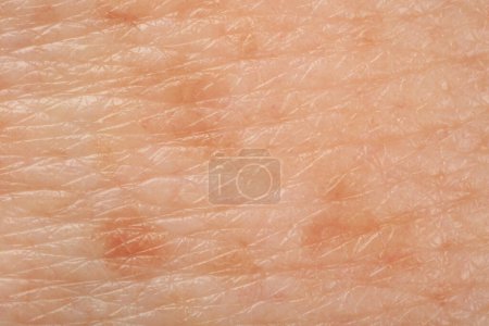 Foto de Textura de la piel con pigmentación como fondo, vista macro - Imagen libre de derechos