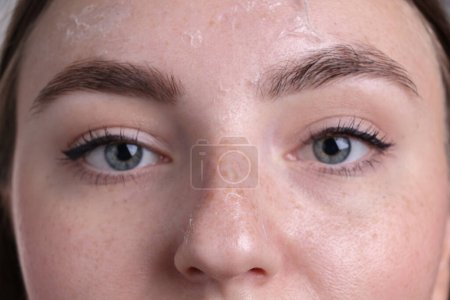 Foto de Mujer con la piel seca en la cara, vista macro - Imagen libre de derechos