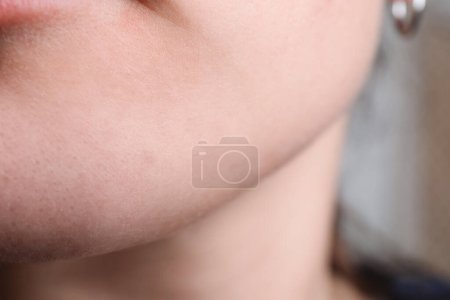 Foto de Mujer con piel seca en la cara, primer plano - Imagen libre de derechos