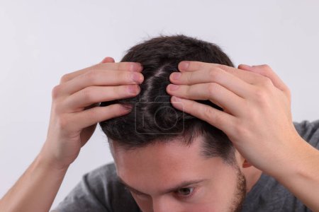 Man examining his hair and scalp on white background, closeup