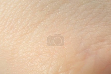 Textur trockener Haut als Hintergrund, Makroansicht