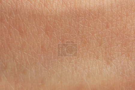 Textur trockener Haut als Hintergrund, Makroansicht