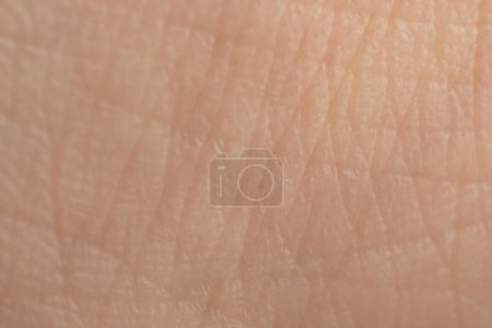 Textura de piel seca como fondo, vista macro