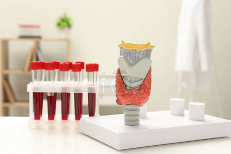 Foto de Endocrinología. Modelo de glándula tiroides y muestras de sangre en tubos de ensayo en mesa blanca en la clínica - Imagen libre de derechos