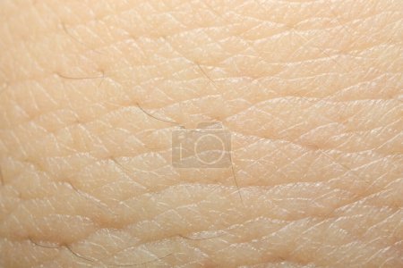 Foto de Textura de piel seca como fondo, vista macro - Imagen libre de derechos