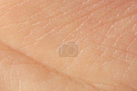 Texture de la peau sèche comme fond, vue macro