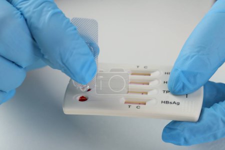 Doctor dropping buffer solution onto disposable multi-infection express test cassette at white table, closeup
