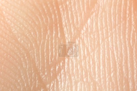 Textura de piel seca como fondo, vista macro