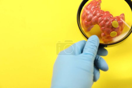 Photo for Endocrinologist looking at model of thyroid gland through magnifying glass on yellow background, closeup. Space for text - Royalty Free Image