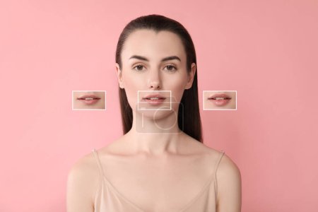 Attraktive Frau mit schönen Lippen auf rosa Hintergrund. Vergrößerte Bereiche zeigen Unterschiede in der Lippenfülle aufgrund kosmetischer Eingriffe