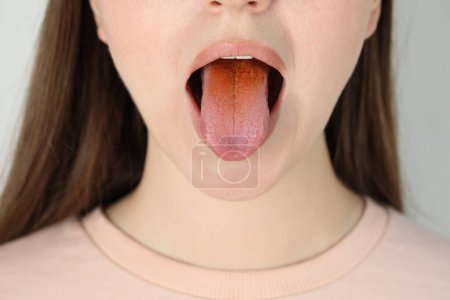 Foto de Enfermedades gastrointestinales. Mujer mostrando su lengua amarilla sobre fondo gris claro, primer plano - Imagen libre de derechos