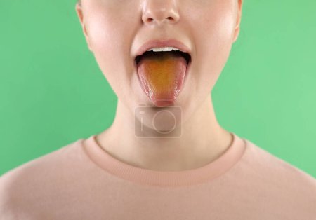 Foto de Enfermedades gastrointestinales. Mujer mostrando su lengua amarilla sobre fondo verde, primer plano - Imagen libre de derechos
