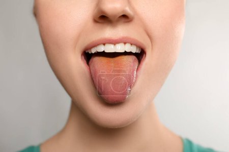 Foto de Enfermedades gastrointestinales. Mujer mostrando su lengua amarilla sobre fondo blanco, primer plano - Imagen libre de derechos