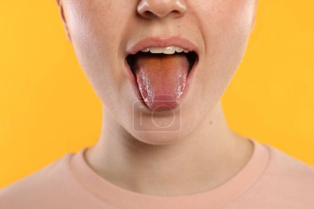 Photo for Gastrointestinal diseases. Woman showing her yellow tongue on color background, closeup - Royalty Free Image