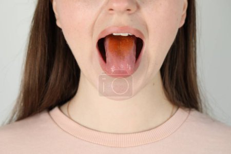 Enfermedades gastrointestinales. Mujer mostrando su lengua amarilla sobre fondo gris claro, primer plano