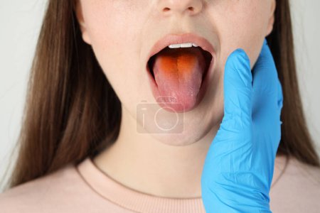 Foto de Gastroenterólogo examinando paciente con lengua amarilla sobre fondo gris claro, primer plano - Imagen libre de derechos