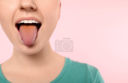 Foto de Enfermedades gastrointestinales. Mujer mostrando su lengua amarilla sobre fondo rosa, primer plano. Espacio para texto - Imagen libre de derechos