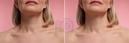 Photo for Aging skin changes. Collage with photos of mature woman before and after cosmetic procedure on pink background, closeup - Royalty Free Image