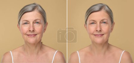 Die alternde Haut verändert sich. Collage mit Fotos reifer Frauen vor und nach kosmetischen Eingriffen auf beigem Hintergrund