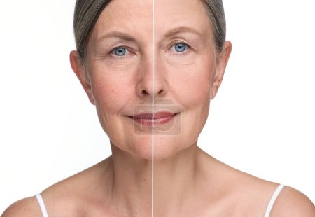 Téléchargez les photos : Le vieillissement de la peau change. Collage avec des photos de femme mûre avant et après la procédure cosmétique sur fond blanc - en image libre de droit