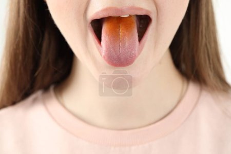 Enfermedades gastrointestinales. Mujer mostrando su lengua amarilla, primer plano