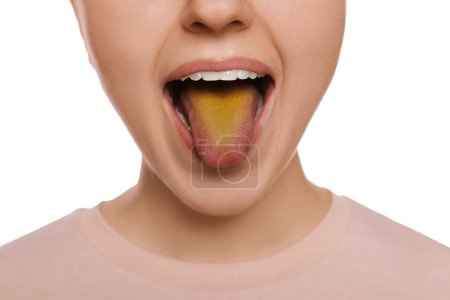 Foto de Enfermedades gastrointestinales. Mujer mostrando su lengua amarilla sobre fondo blanco, primer plano - Imagen libre de derechos