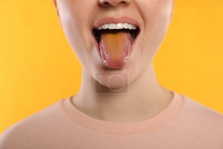 Foto de Enfermedades gastrointestinales. Mujer mostrando su lengua amarilla sobre fondo de color, primer plano - Imagen libre de derechos