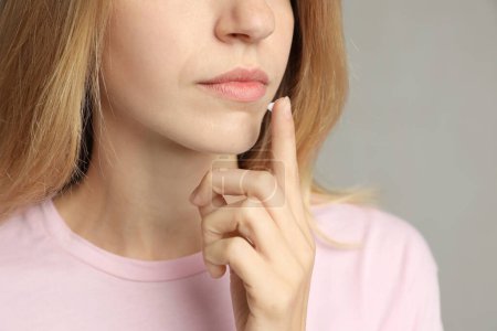 Femme avec herpès appliquant de la crème sur la lèvre sur fond gris clair, gros plan