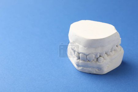 Photo for Dental model with gums on blue background, space for text. Cast of teeth - Royalty Free Image