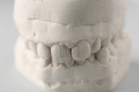 Photo for Dental model with gums on light grey background, closeup. Cast of teeth - Royalty Free Image