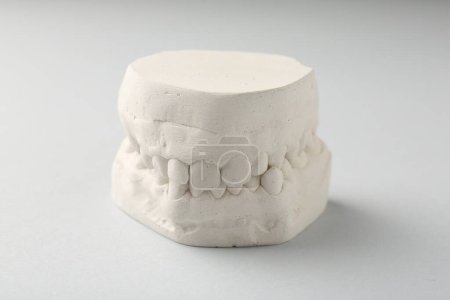 Photo for Dental model with gums on light grey background. Cast of teeth - Royalty Free Image