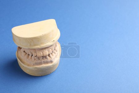 Photo for Dental model with gums on blue background, space for text. Cast of teeth - Royalty Free Image