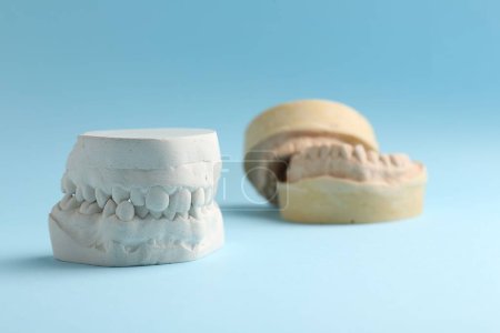 Photo for Dental model with gums on light blue background. Cast of teeth - Royalty Free Image