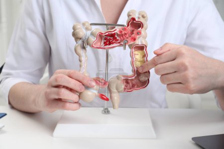 Photo for Doctor showing model of large intestine at white table in clinic, closeup - Royalty Free Image
