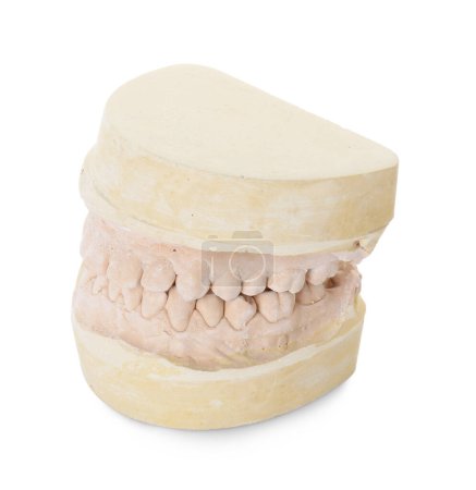 Dentalmodell mit Kiefer isoliert auf weiß. Zähneputzen