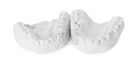 Photo for Dental model with gums isolated on white. Cast of teeth - Royalty Free Image