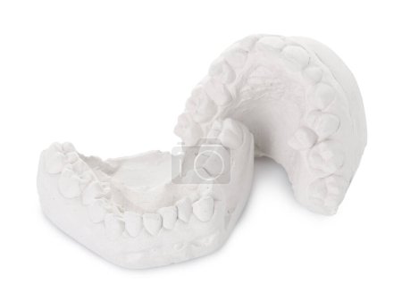 Photo for Dental model with gums isolated on white. Cast of teeth - Royalty Free Image