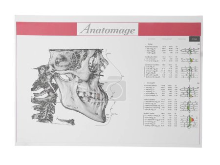 Téléchargez les photos : Visualisation de la section maxillofaciale humaine pour analyse dentaire imprimée sur papier isolé sur blanc - en image libre de droit