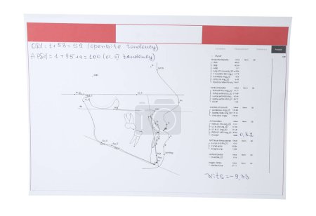 Téléchargez les photos : Visualisation de la section maxillofaciale humaine pour analyse dentaire imprimée sur papier isolé sur blanc - en image libre de droit