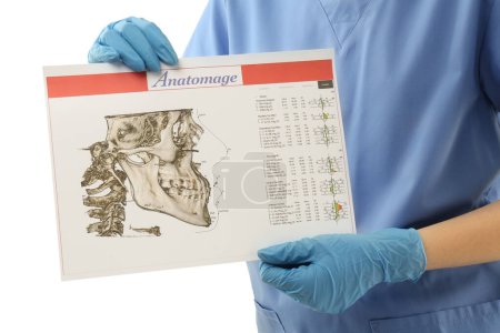 Doctor with visualization of human maxillofacial section for dental analysis printed on paper isolated on white, closeup. Cast of teeth