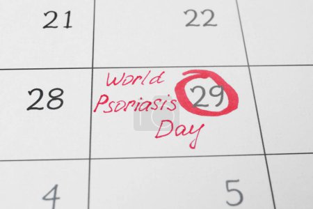 Día Internacional de la Psoriasis. Página del calendario con la fecha marcada como fondo, primer plano